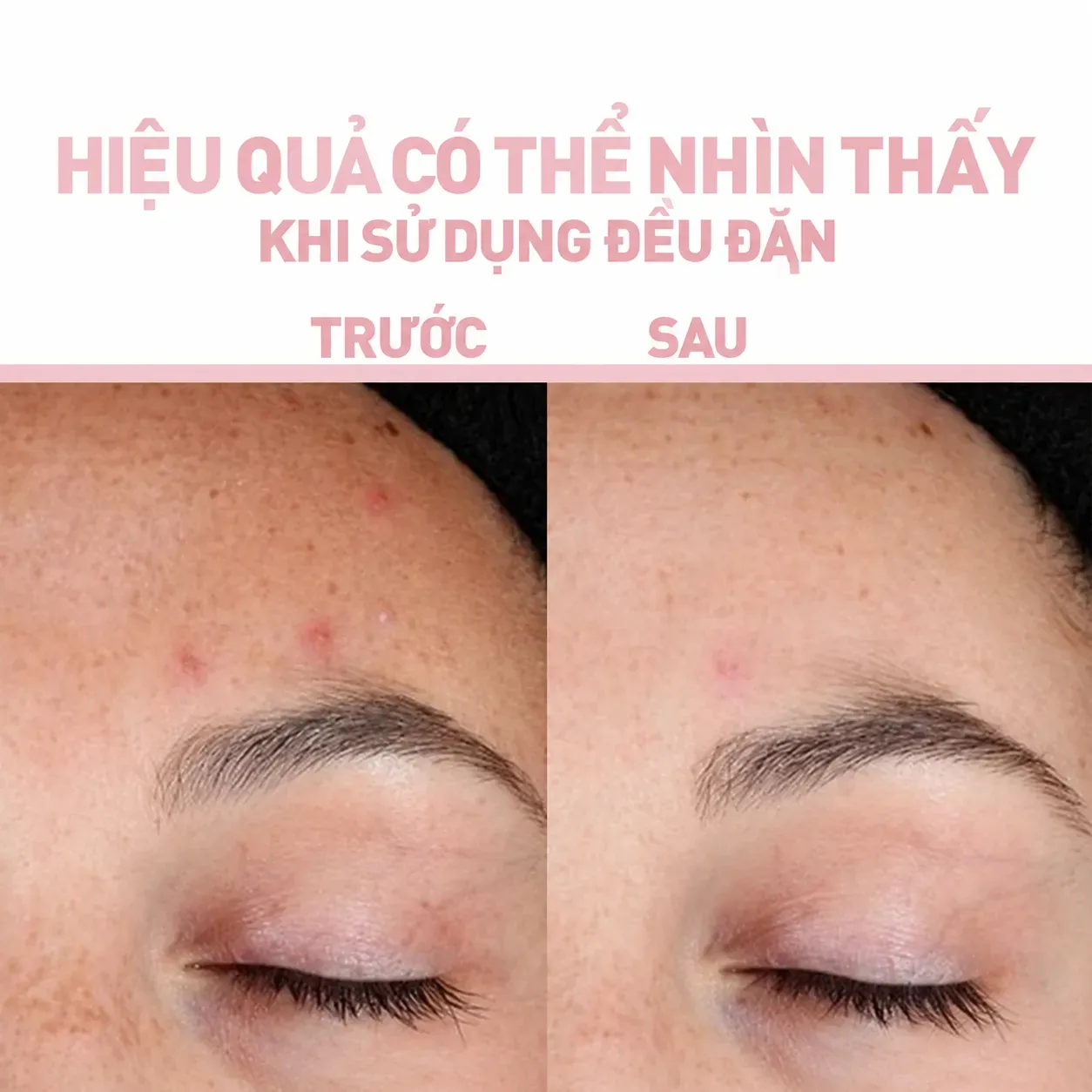 Ảnh thu nhỏ
