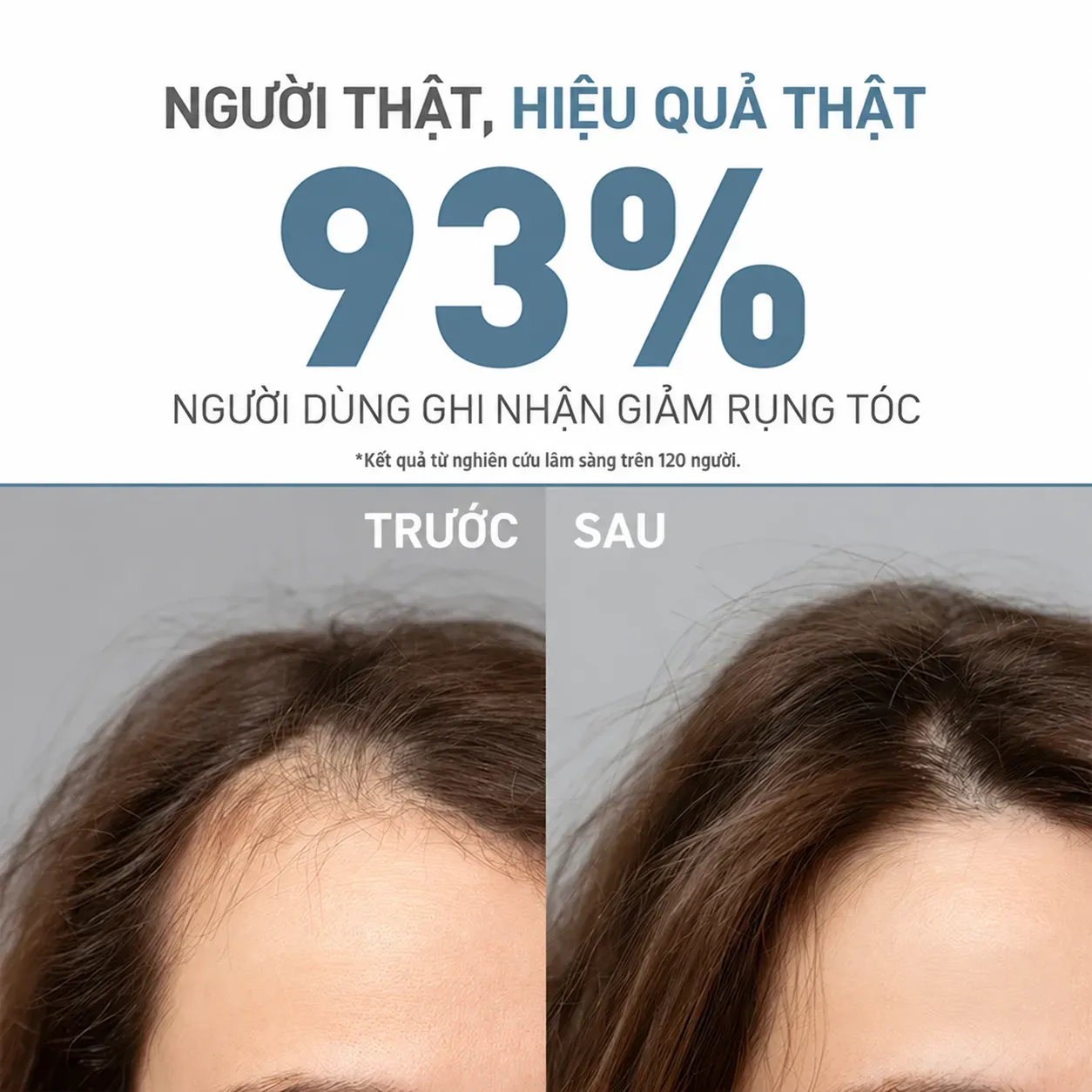 Dầu gội cho tóc khô và hư tổn Bionnex Organica Anti-Hair Loss Shampoo for Dry and Damaged Hair 300ml Hover