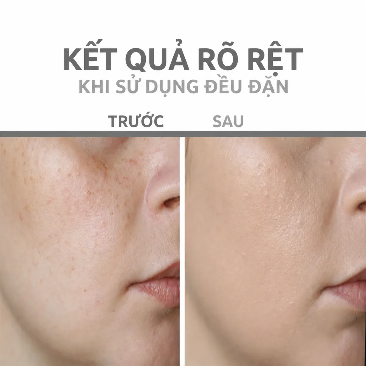 Ảnh thu nhỏ