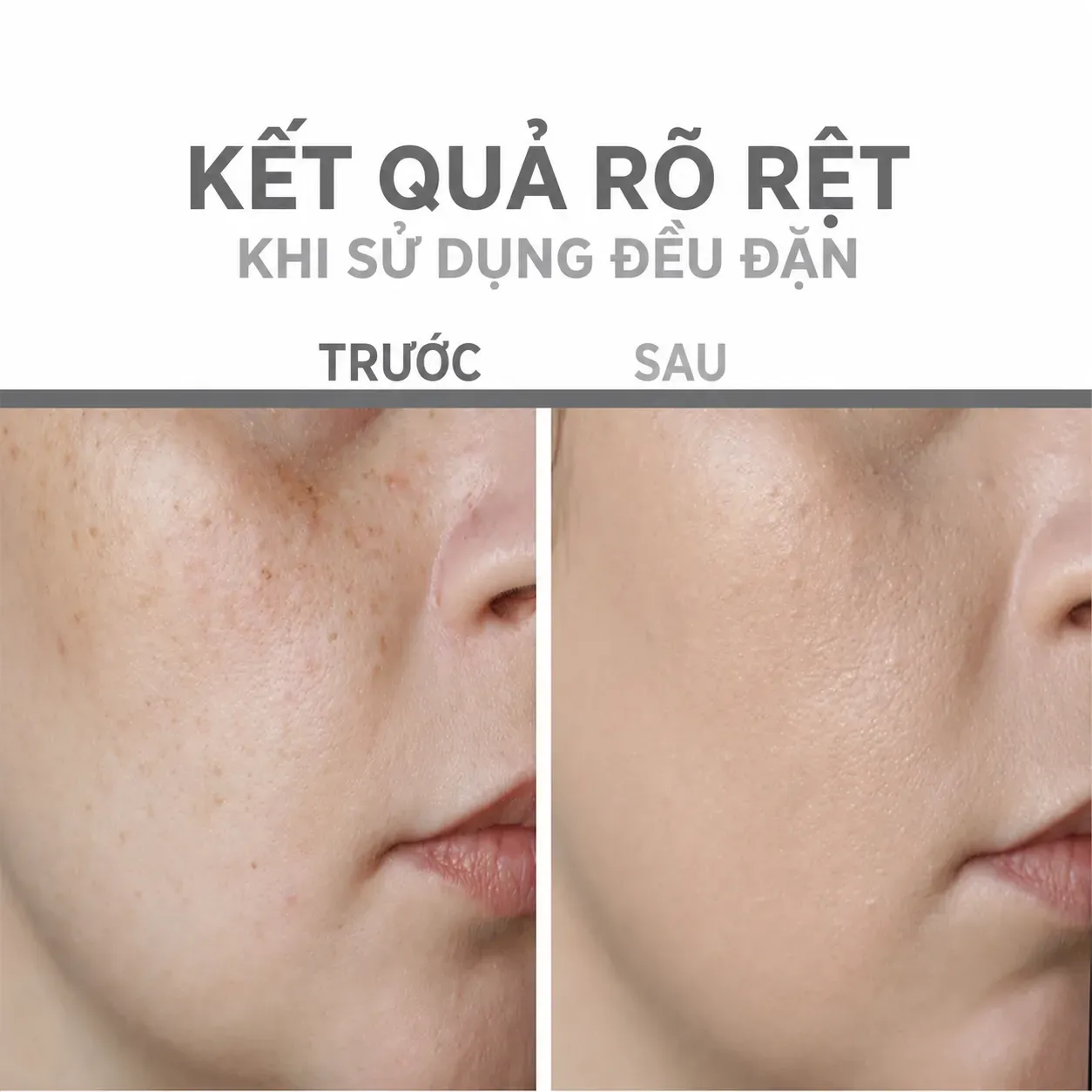 Ảnh thu nhỏ